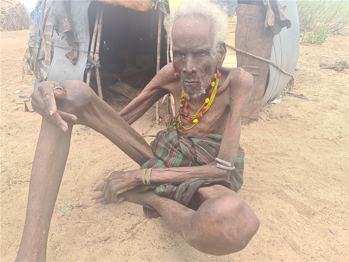 Nakali Lomorimoi leidet unter der anhaltende Dürre und hat kaum etwas Essen. © Sign of Hope e.V.